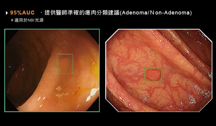 消化管内視鏡について | 輝雄クリニック